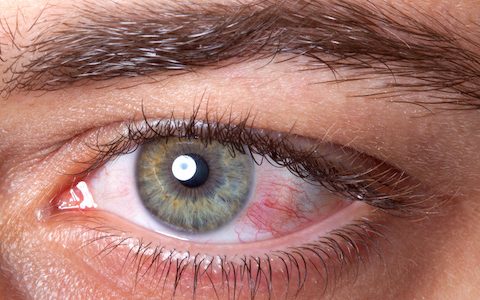 Ikervis ciclosporin treatment now PBS-listed