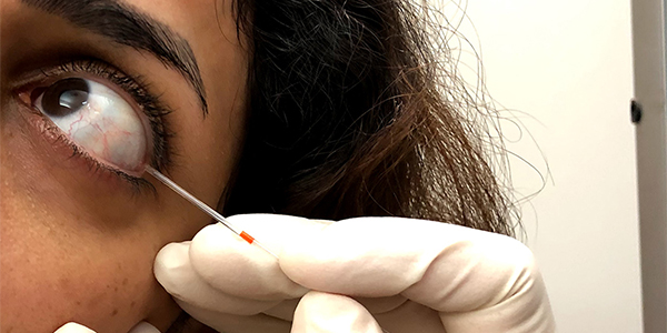 Tears can help detect diabetic peripheral nerve damage