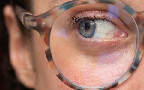 Census data reveals millions of Australians living with eye conditions