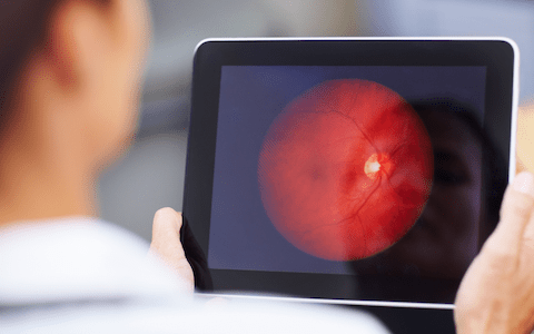 Optometry Australia welcomes launch of Australia’s new National Digital Health Strategy 2023-28