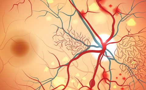 Pharma Open Access: Optometry Australia revises guidelines for diabetic retinopathy