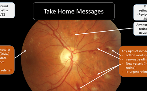 Take home messages for diabetic retinopathy