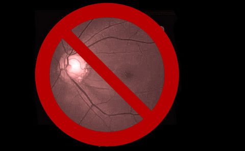 Mistakes not to make in glaucoma management