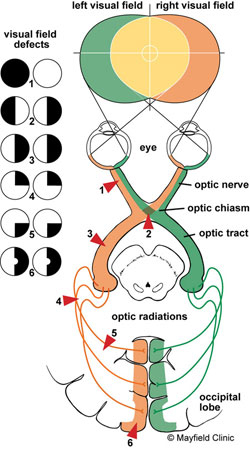 Figure 1 - online