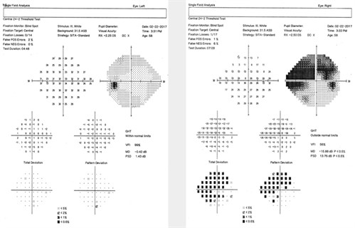 Pharma-ONLINE-March-Steroids-Figure-1