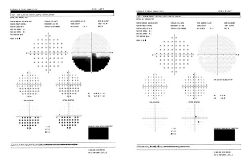 Pharma-ONLINE-sleep-apnoea-Figure-2