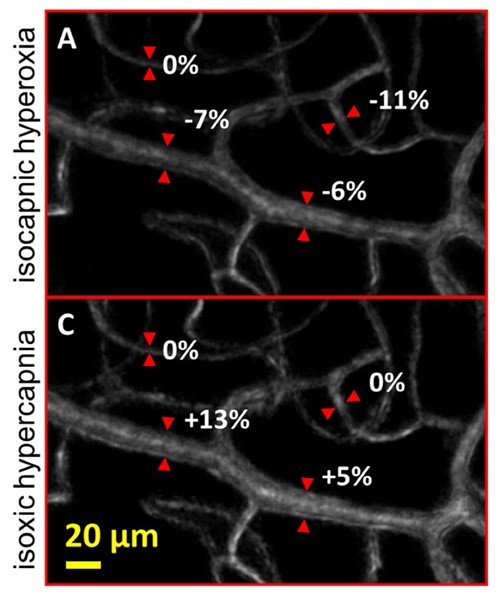 Retinal arteriole - online