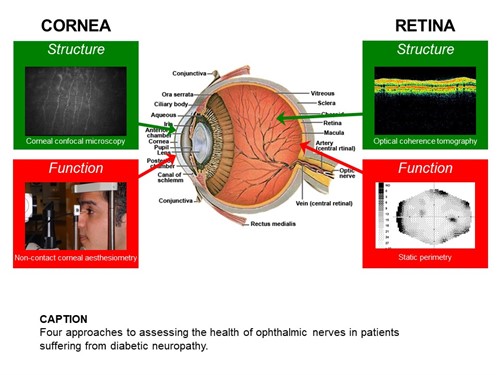 Slide 1 - cornea and retina